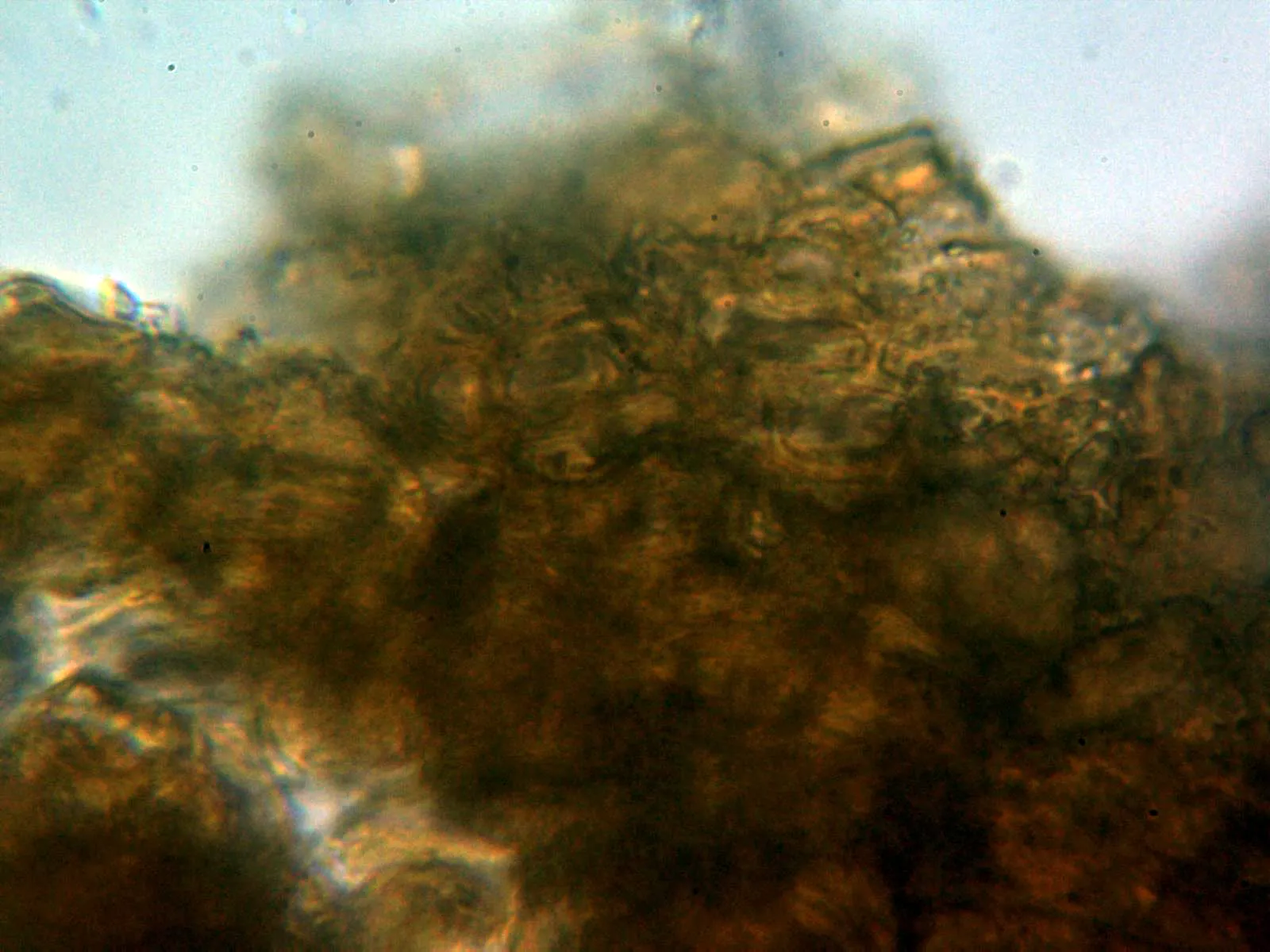 Microscopía de Tuber fulgens - 10 - Peridio externo agua 2